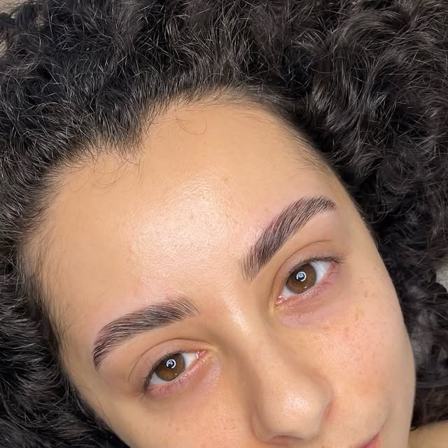 Een brow lift, van dichtbij